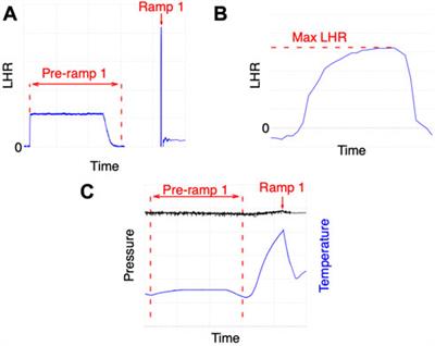 Fuel performance uncertainty quantification and sensitivity analysis in the presence of epistemic and aleatoric sources of uncertainties